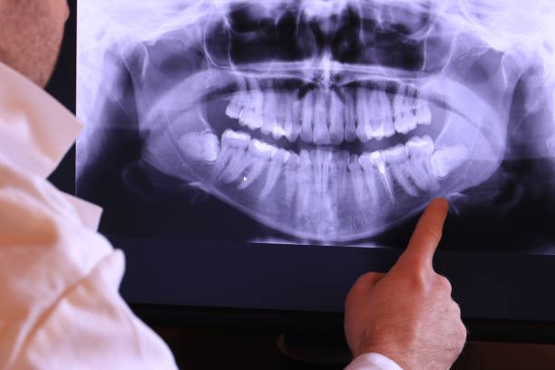 Best Broken or Chipped Tooth Repair in Marion, SC